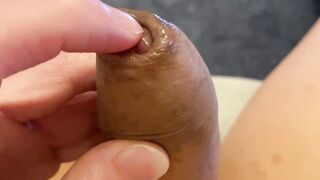 Sloppy foreskin fingering with lots of sticky precum