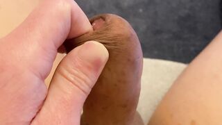 Sloppy foreskin fingering with lots of sticky precum