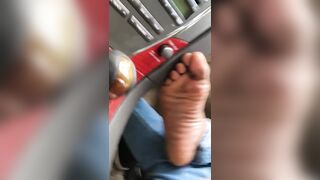 Tasty toes and big sore bunion feet