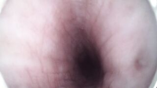 Endoscope through urethra to prostate while masterbating